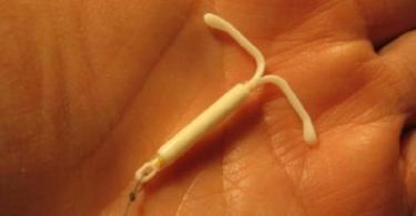 Внутриматочная спираль: контрацепция и лечение в гинекологии
